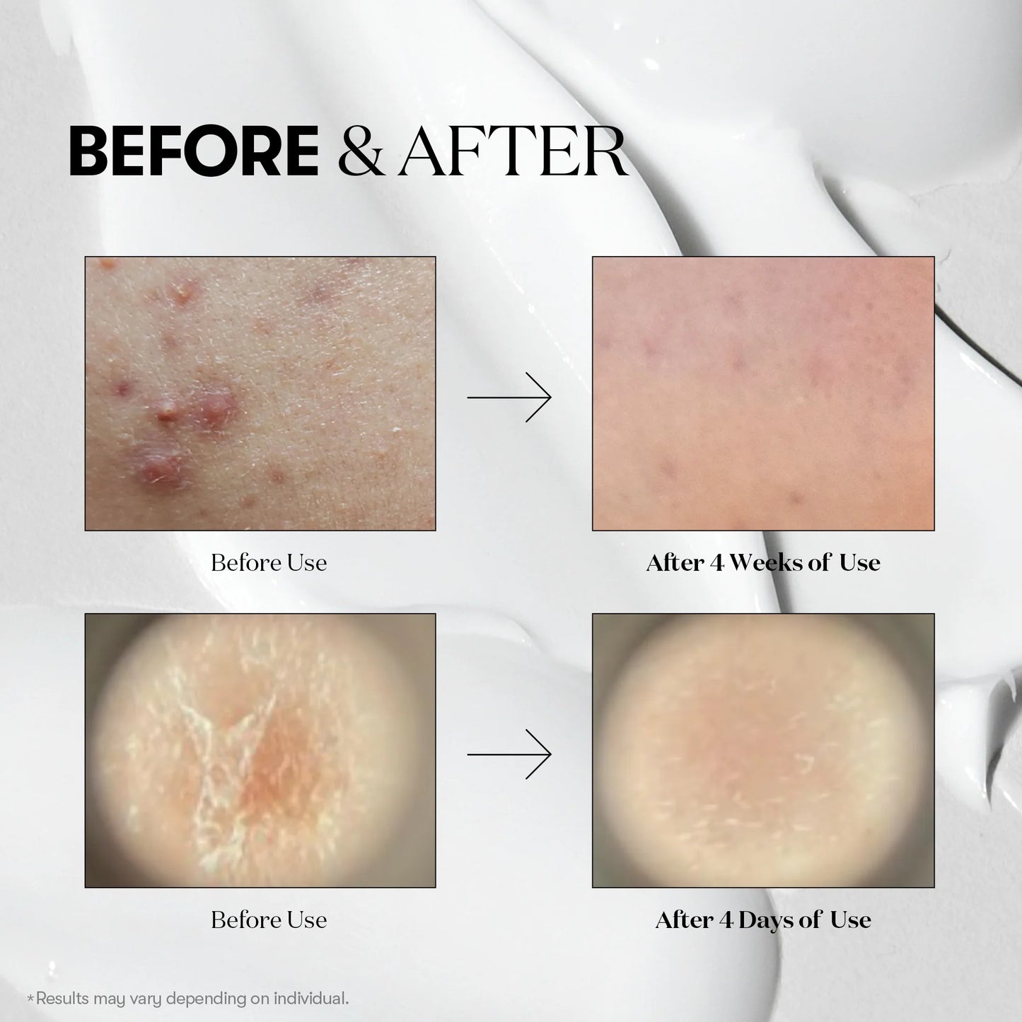 SIERO VISO REEDLE SHOT 100 VT COSMETICS