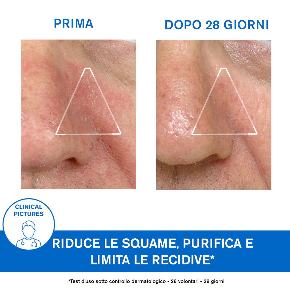 URIAGE TRATTAMENTO REGOLATORE 40ML