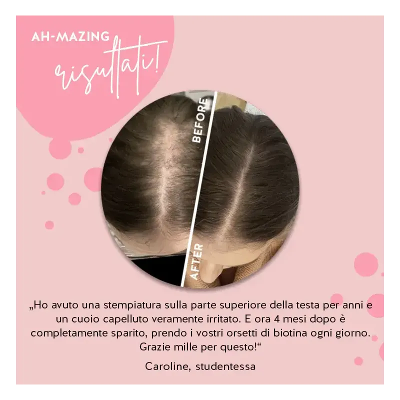 AH-MAZING HAIR VITAMIN BIOTINA PER CAPELLI FORTI 45 ORSETTI GOMMOSI SENZA ZUCCHERO
