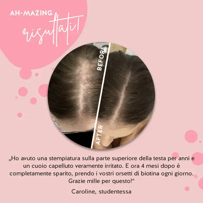 AH-MAZING HAIR VITAMIN BIOTINA 60 COMPRESSE GOMMOSE