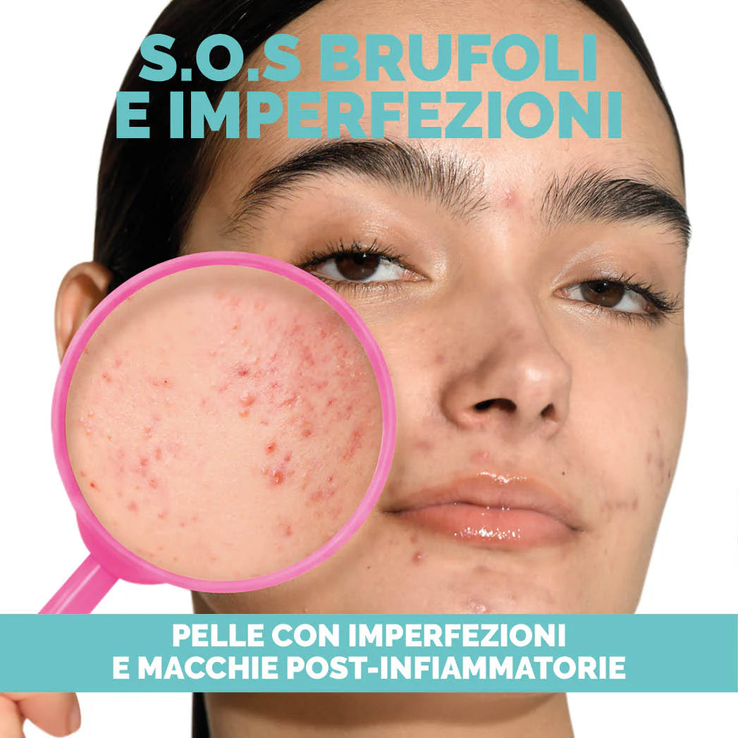 VERALAB KIT S.O.S. BRUFOLI E IMPERFEZIONI