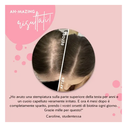 AH-MAZING HAIR VITAMIN BIOTINA PER CAPELLI FORTI 45 ORSETTI GOMMOSI SENZA ZUCCHERO